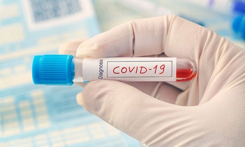 Koronavirüs testi pozitif çıktığı